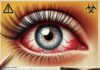 A young woman with a visibly damaged, irritated eye caused by excessive use of eyelash extensions and colored contact lenses.